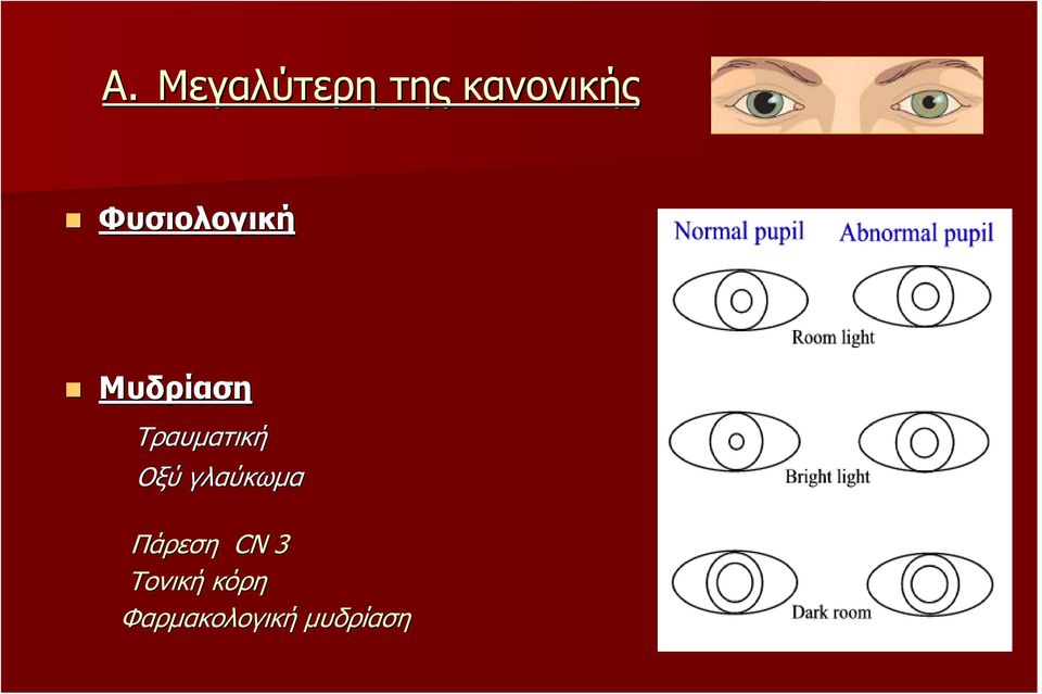 Tραυµατική Οξύ γλαύκωµα