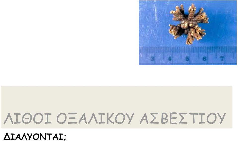 ΑΣΒΕΣΤΙΟΥ