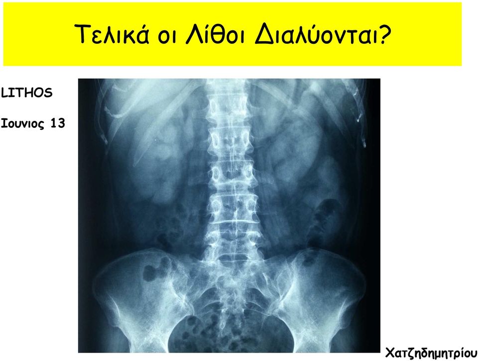 Διαλύονται?