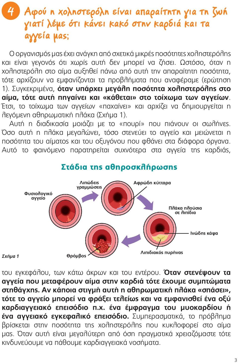 Συγκεκριμένα, όταν υπάρχει μεγάλη ποσότητα χοληστερόλης στο αίμα, τότε αυτή πηγαίνει και «κάθεται» στο τοίχωμα των αγγείων.