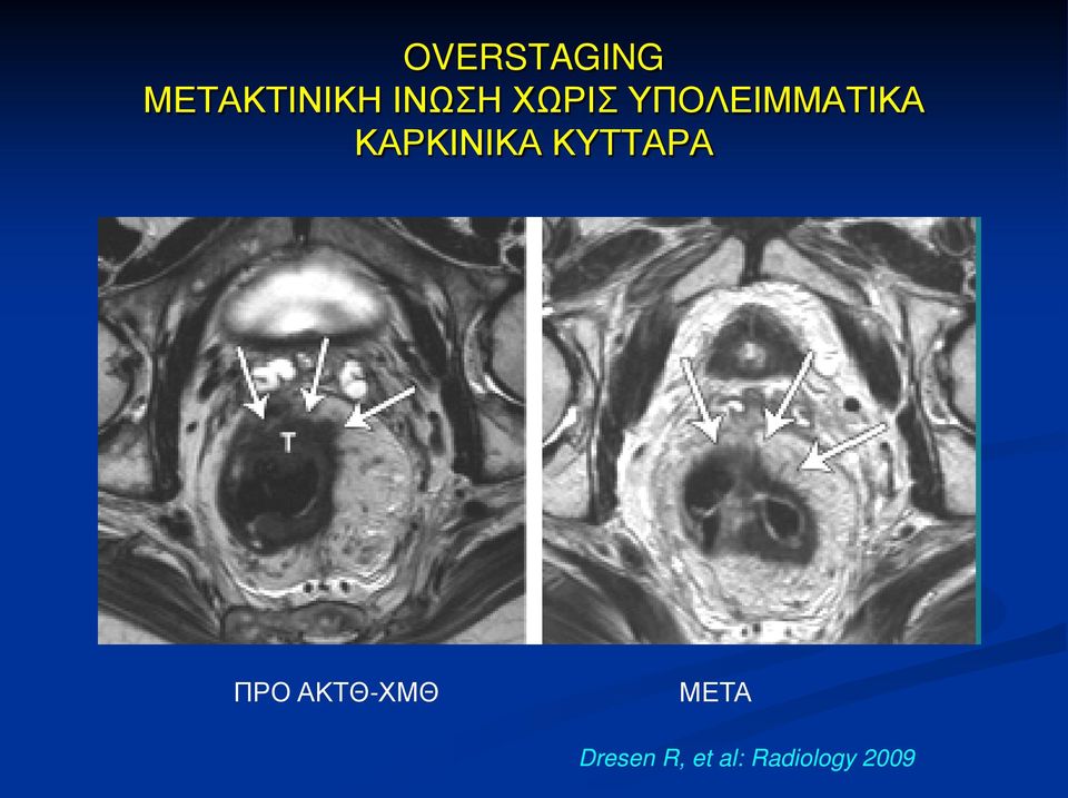 ΚΥΤΤΑΡΑ ΠΡΟ ΑΚΤΘ-ΧΜΘ ΜΕΤΑ