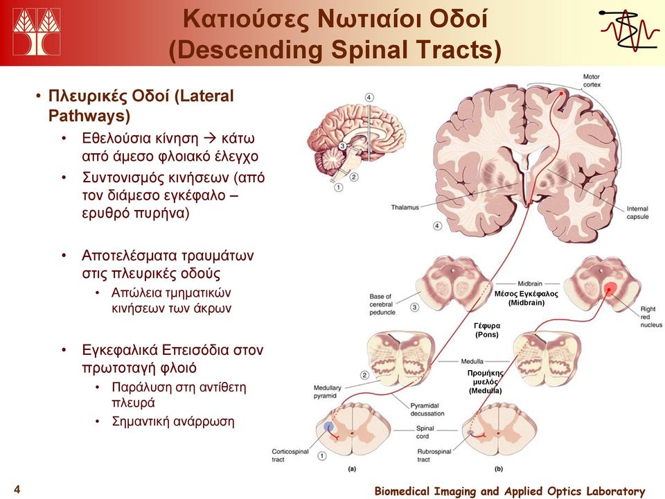 τραυμάτων στις πλευρικές οδούς Απώλεια τμηματικών κινήσεων των άκρων Μέσος Εγκέφαλος (Midbrain) Εγκεφαλικά