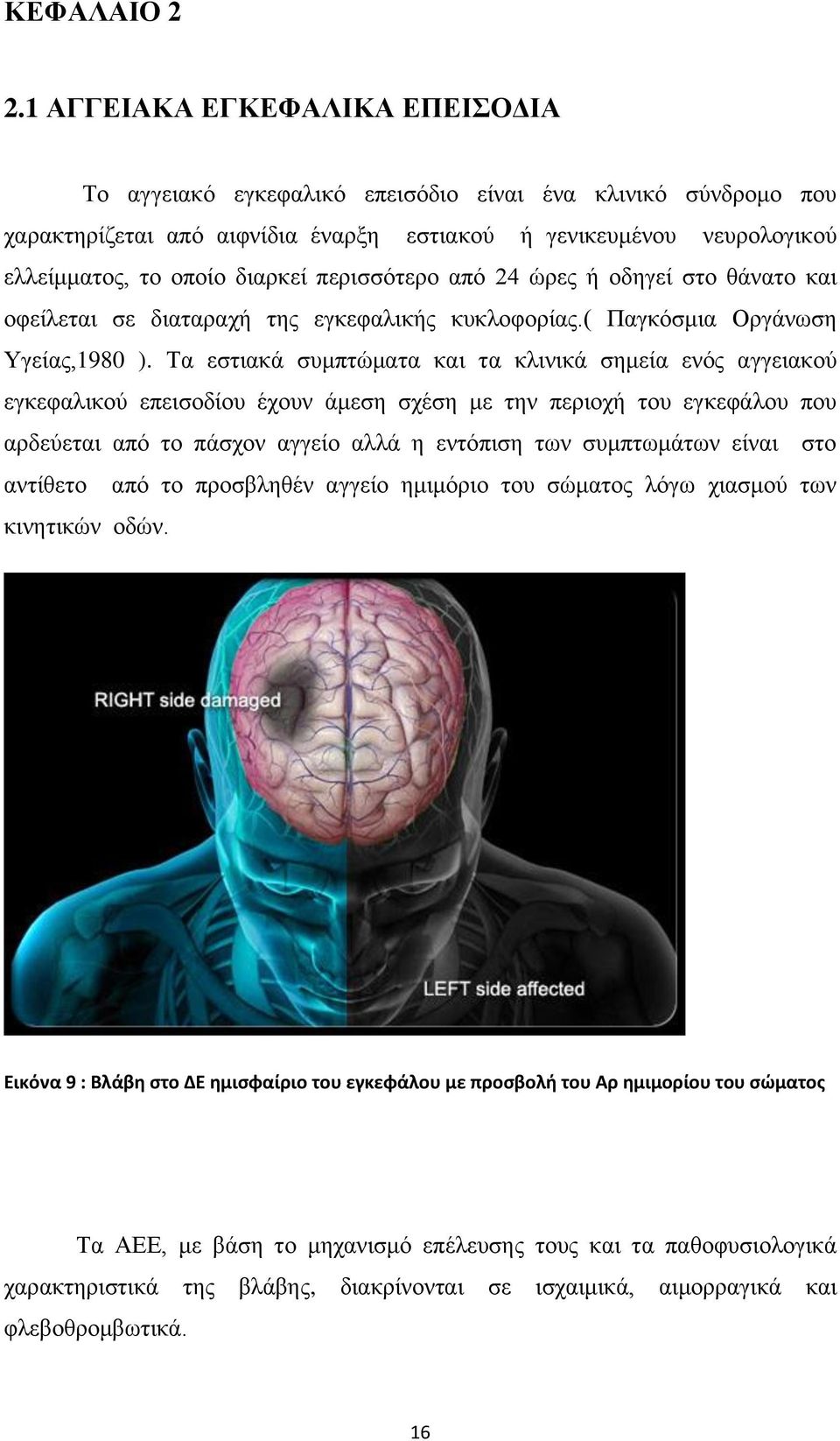 περισσότερο από 24 ώρες ή οδηγεί στο θάνατο και οφείλεται σε διαταραχή της εγκεφαλικής κυκλοφορίας.( Παγκόσμια Οργάνωση Υγείας,1980 ).