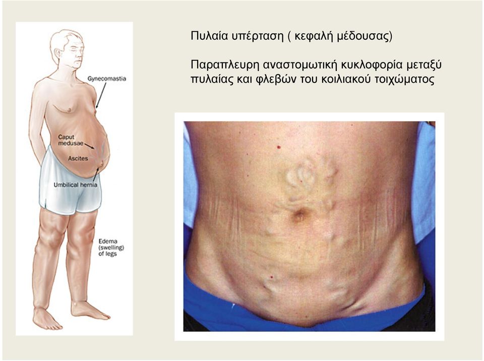 αναστοµωτική κυκλοφορία