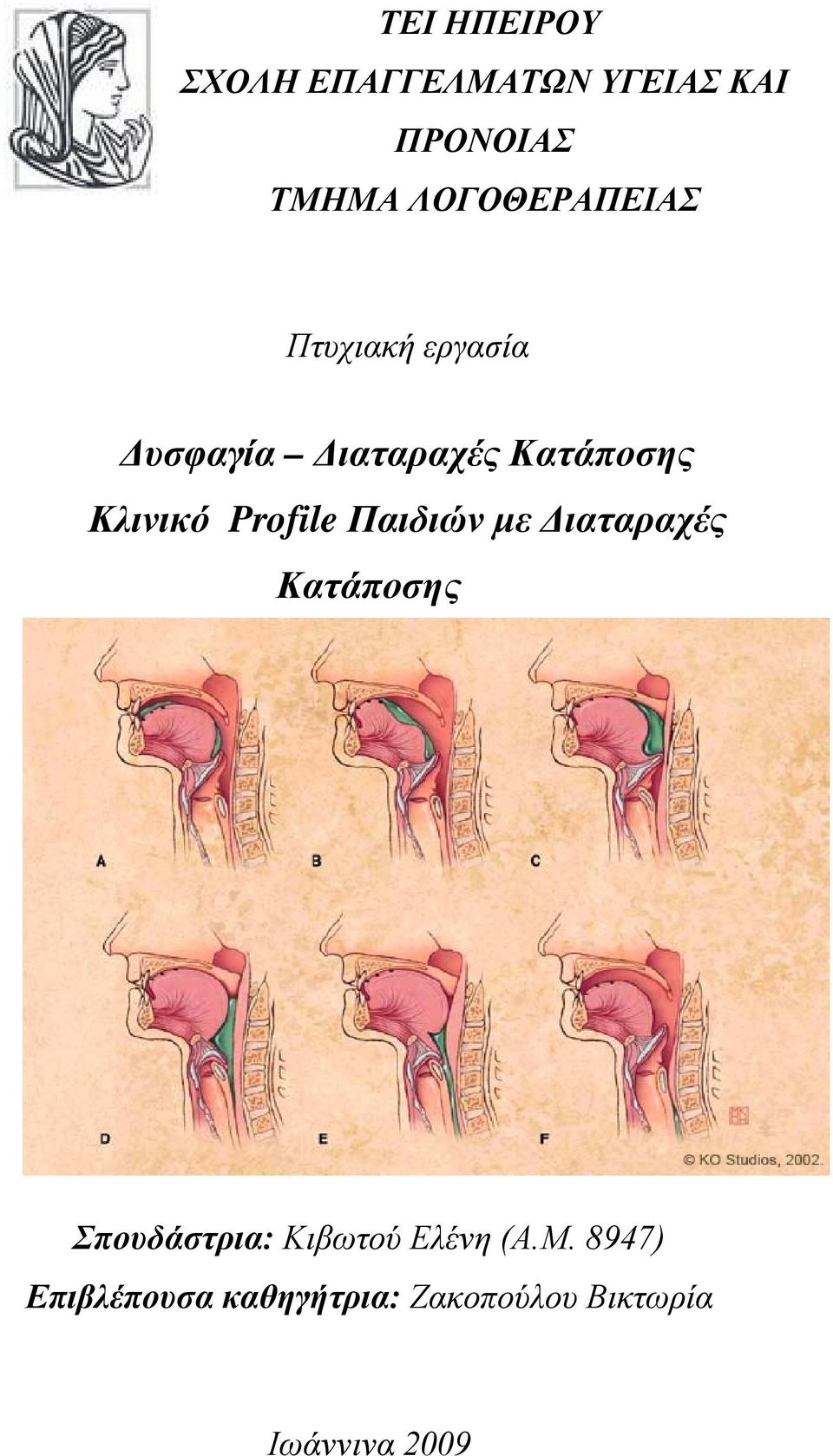 Κλινικό Profile Παιδιών με Διαταραχές Κατάποσης Σπουδάστρια: