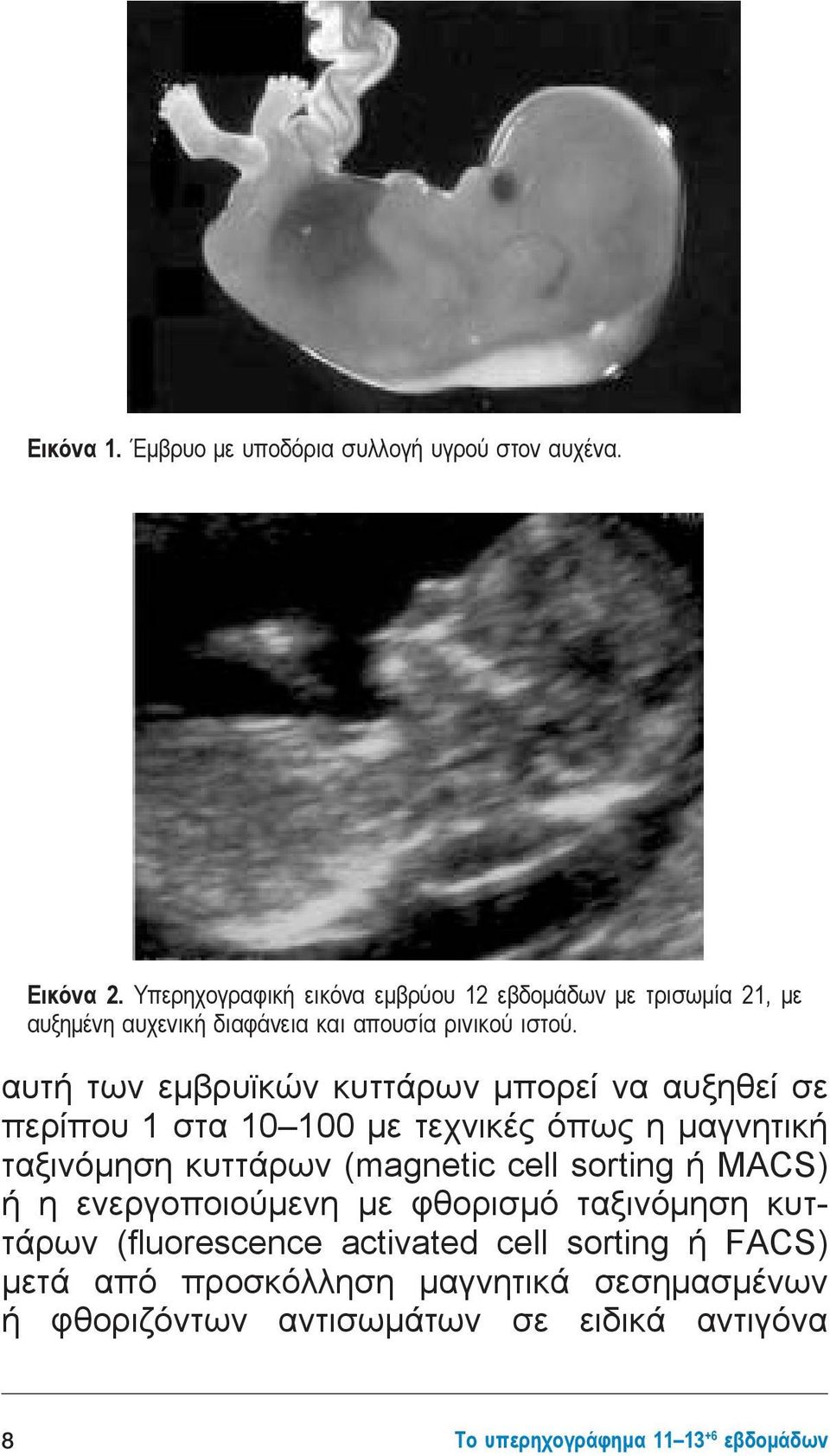 αυτή των εμβρυϊκών κυττάρων μπορεί να αυξηθεί σε περίπου 1 στα 10 100 με τεχνικές όπως η μαγνητική ταξινόμηση κυττάρων (magnetic cell