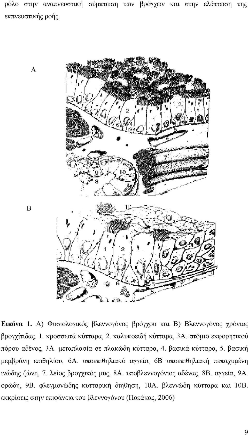 στόμιο εκφορητικού πόρου αδένος, 3Α. μεταπλασία σε πλακώδη κύτταρα, 4. βασικά κύτταρα, 5. βασική μεμβράνη επιθηλίου, 6Α.