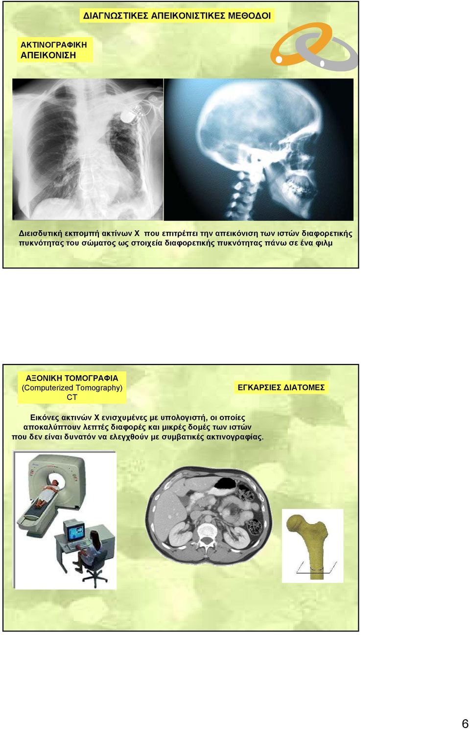 ΑΞΟΝΙΚΗ ΤΟΜΟΓΡΑΦΙΑ (Computerized Tomography) CT ΕΓΚΑΡΣΙΕΣ ΔΙΑΤΟΜΕΣ Εικόνες ακτινών Χ ενισχυμένες με υπολογιστή, οι