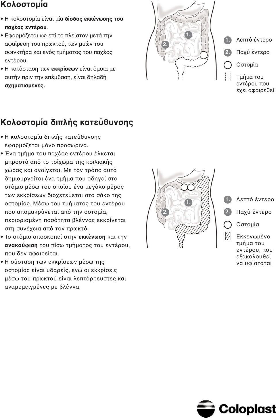 Οστοµία Τµήµα του εντέρου που έχει αφαιρεθεί Κολοστοµία διπλής κατεύθυνσης Η κολοστοµία διπλής κατεύθυνσης εφαρµόζεται µόνο προσωρινά.