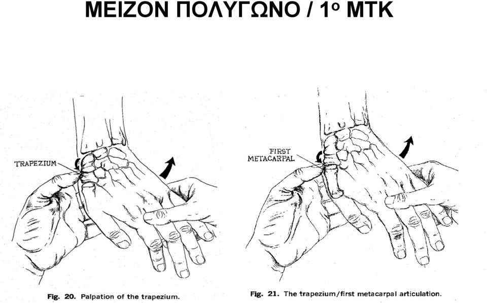 / 1 ο ΜΤΚ