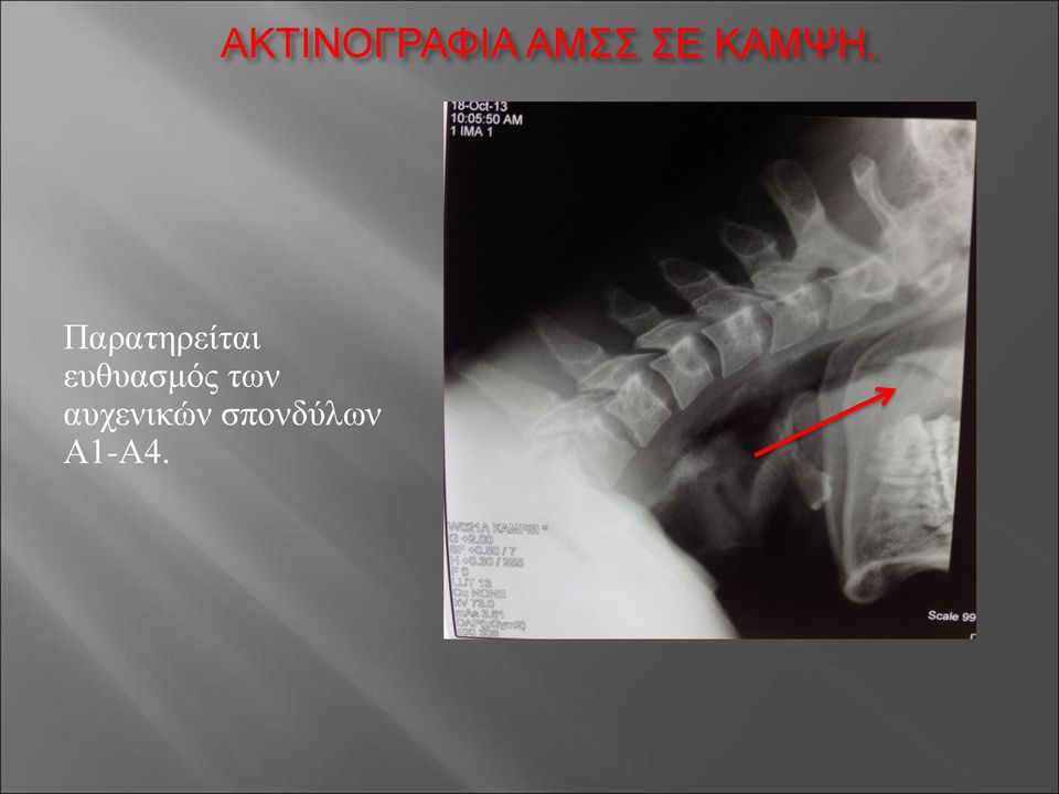 Παρατηρείται