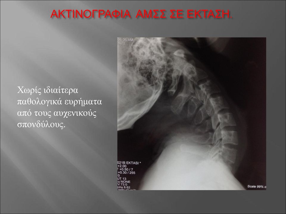 Χωρίς ιδιαίτερα