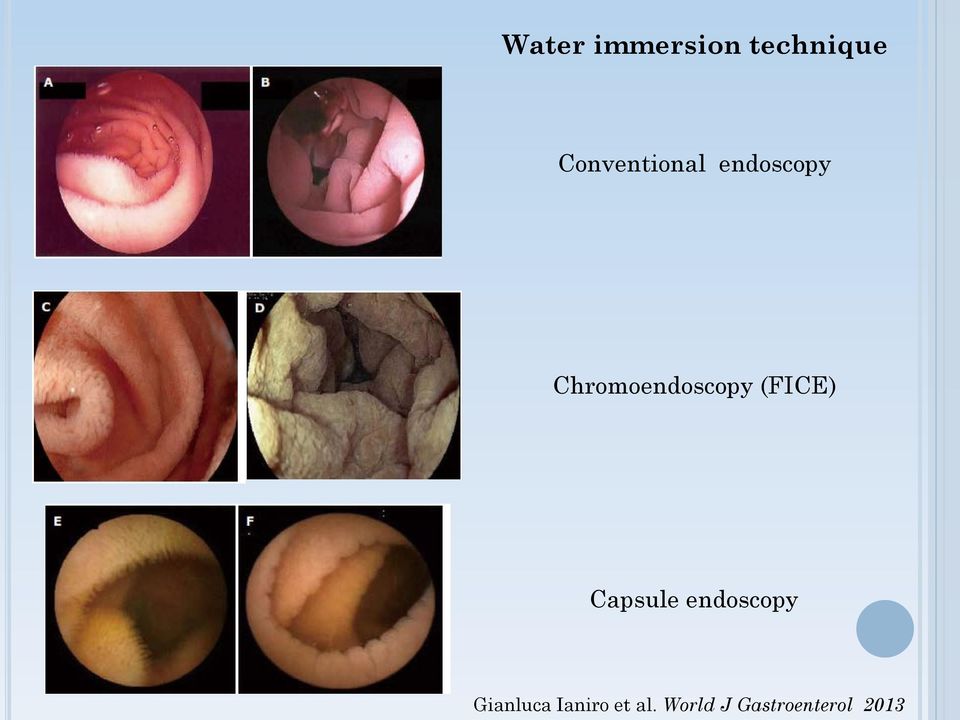 Chromoendoscopy (FICE) Capsule