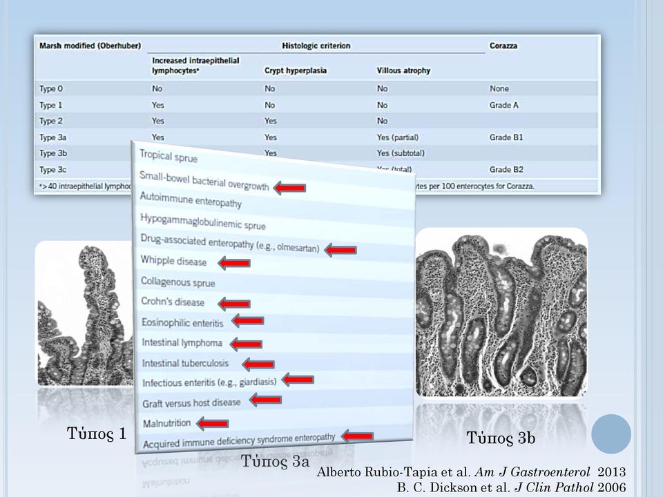 Am J Gastroenterol 2013 B. C.
