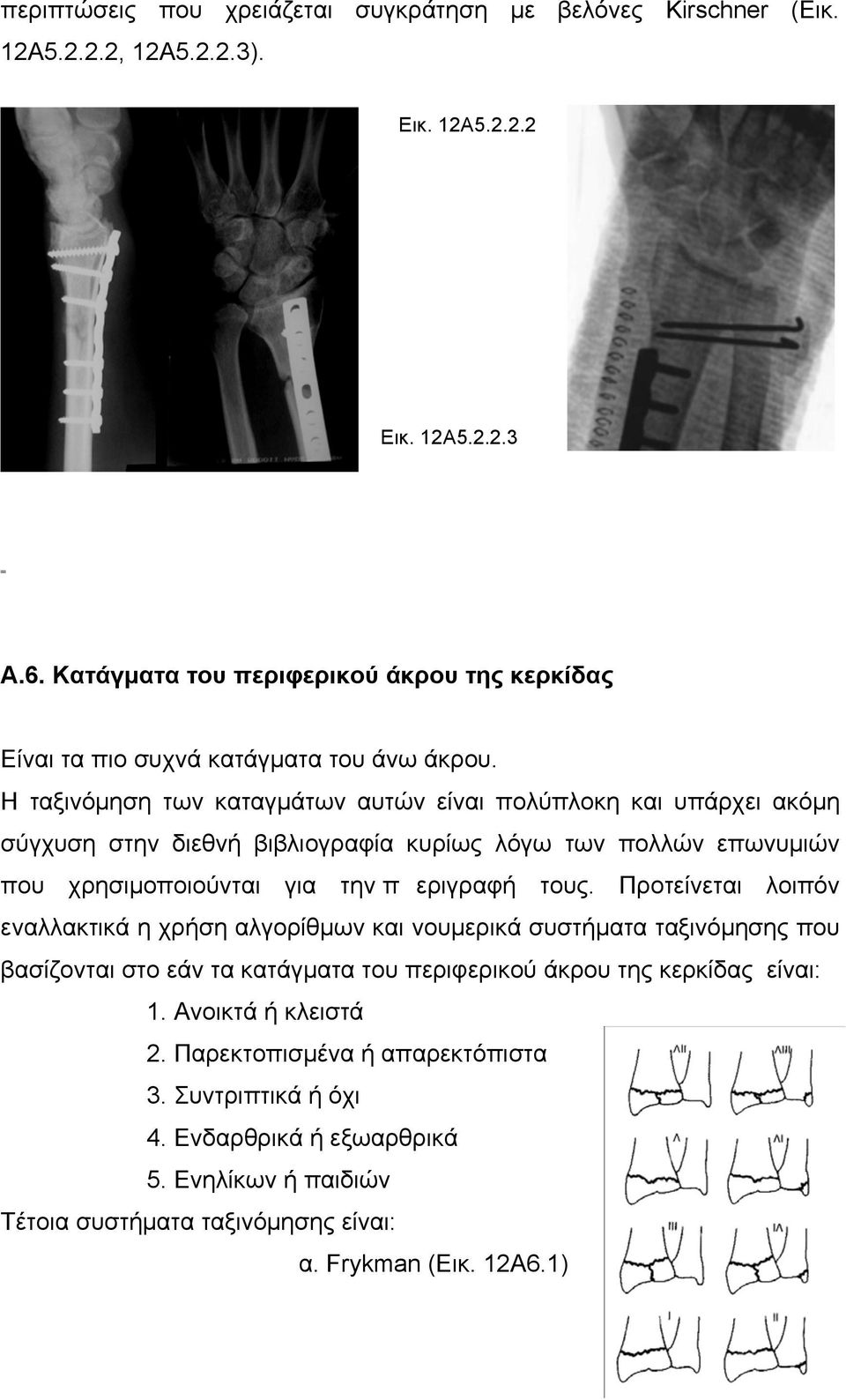 Η ταξινόµηση των καταγµάτων αυτών είναι πολύπλοκη και υπάρχει ακόµη σύγχυση στην διεθνή βιβλιογραφία κυρίως λόγω των πολλών επωνυµιών που χρησιµοποιούνται για την π εριγραφή τους.