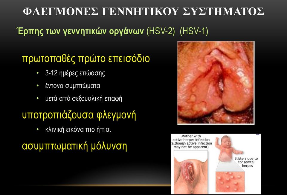 ηµέρες επώασης έντονα συµπτώµατα µετά από σεξουαλική επαφή