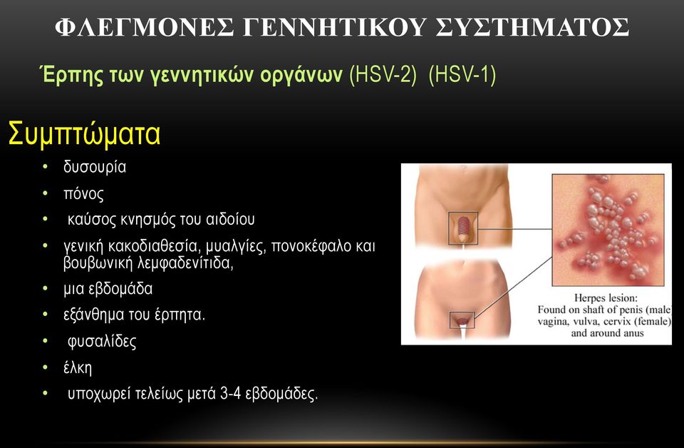 κακοδιαθεσία, µυαλγίες, πονοκέφαλο και βουβωνική λεµφαδενίτιδα, µια