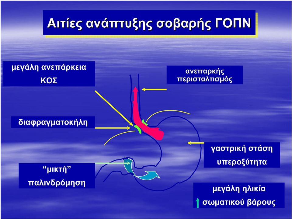 διαφραγματοκήλη μικτή παλινδρόμηση