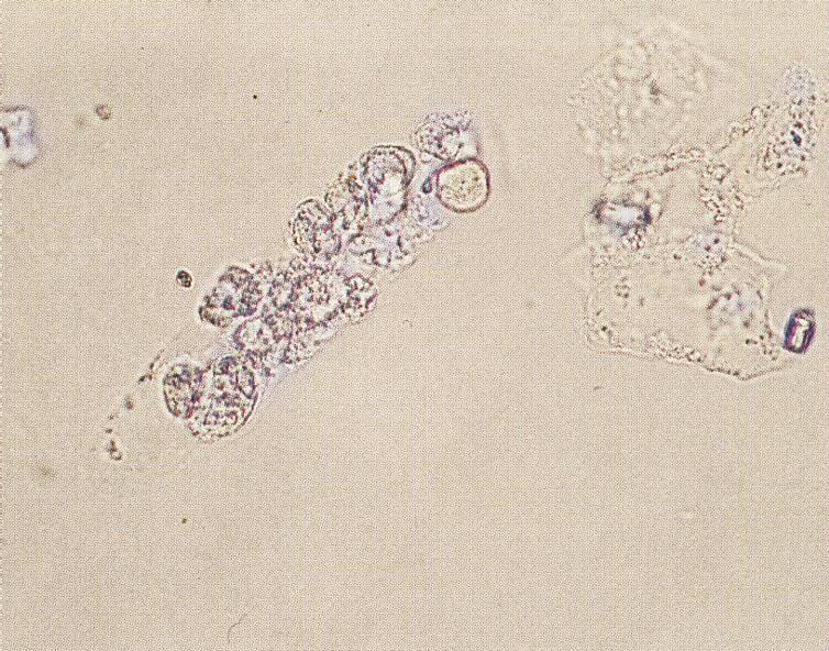 Eritrocitni 