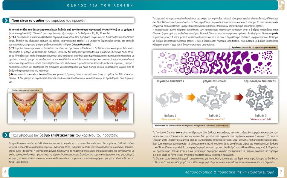 Τ1-2 σημαίνει ότι ο καρκίνος βρίσκεται περιορισμένος μέσα στον προστάτη, χωρίς να έχει διαπεράσει την προστατική κάψα, δηλαδή την εξωτερική κάλυψη του αδένα.