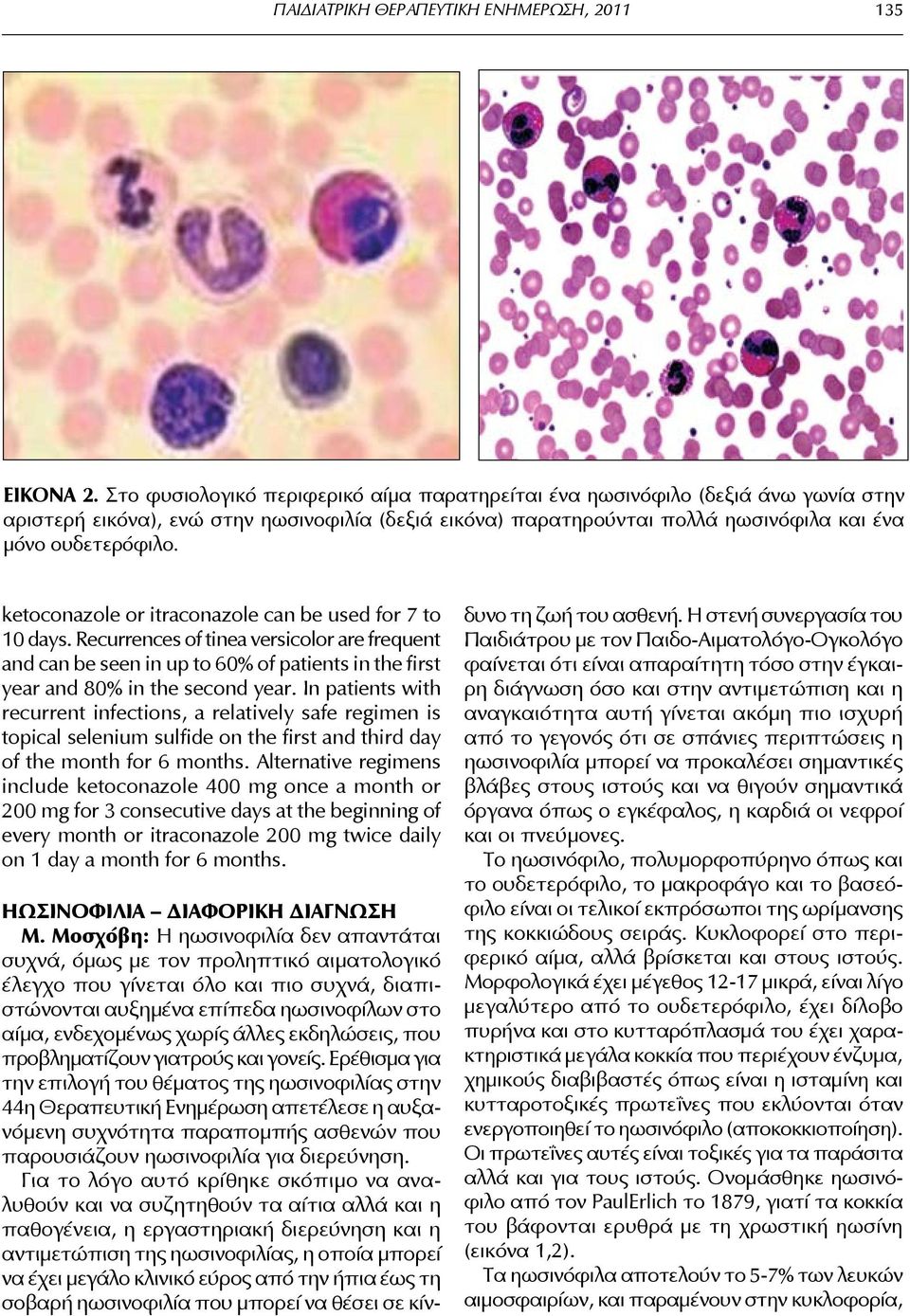 ketoconazole or itraconazole can be used for 7 to 10 days. Recurrences of tinea versicolor are frequent and can be seen in up to 60% of patients in the first year and 80% in the second year.