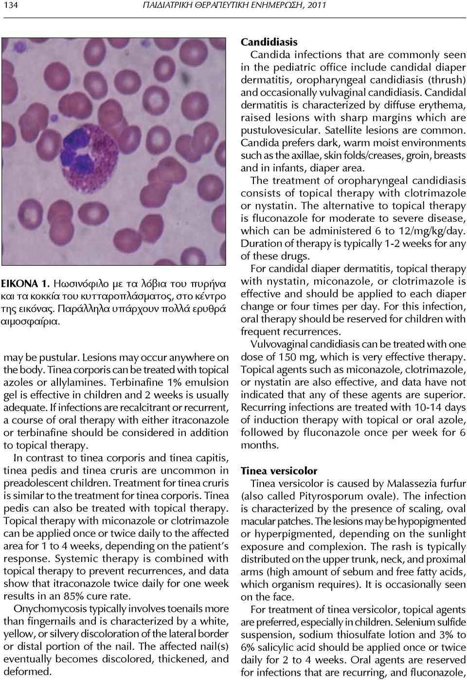 If infections are recalcitrant or recurrent, a course of oral therapy with either itraconazole or terbinafine should be considered in addition to topical therapy.