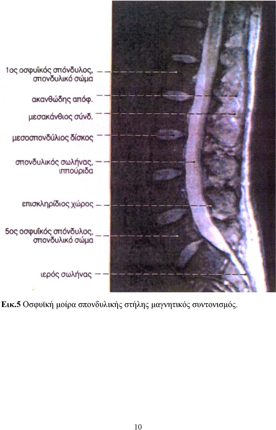 σπονδυλικής