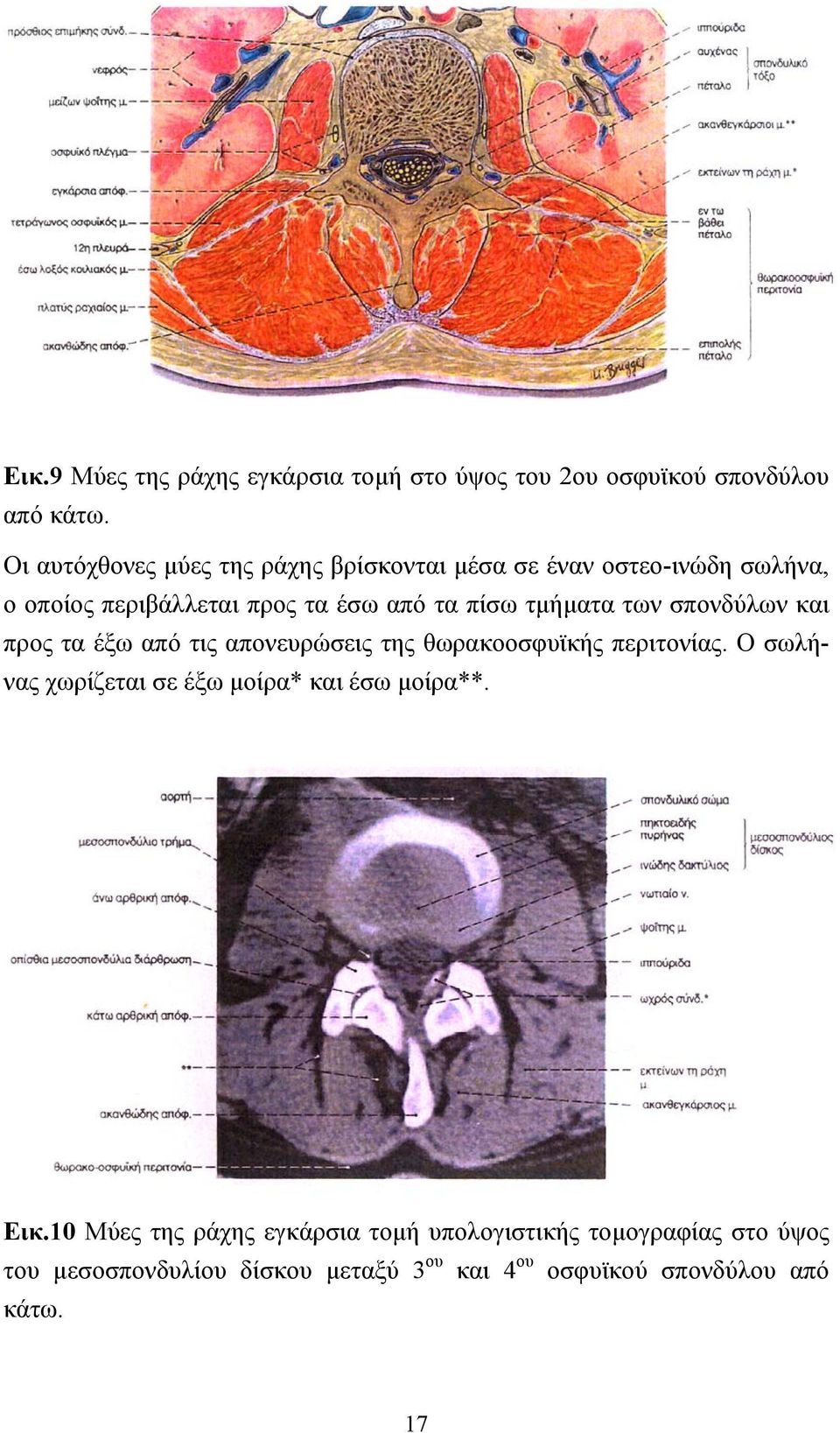 τμήματα των σπονδύλων και προς τα έξω από τις απονευρώσεις της θωρακοοσφυϊκής περιτονίας.