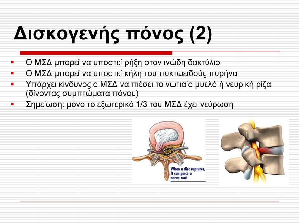 Υπάρχει κίνδυνος ο ΜΣΔ να πιέσει το νωτιαίο μυελό ή νευρική ρίζα