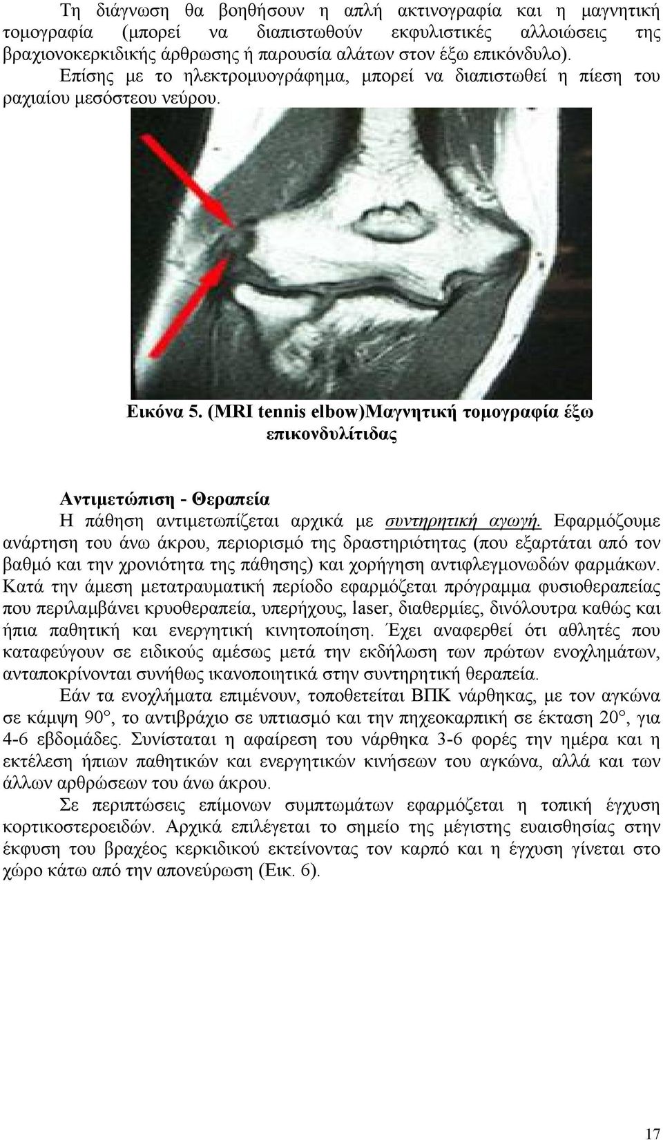 (MRI tennis elbow)μαγνητική τομογραφία έξω επικονδυλίτιδας Αντιμετώπιση - Θεραπεία Η πάθηση αντιμετωπίζεται αρχικά με συντηρητική αγωγή.