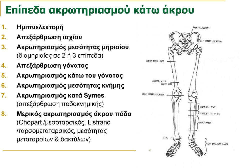 Ακρωτηριασμός κάτω του γόνατος 6. Ακρωτηριασμός μεσότητας κνήμης 7.