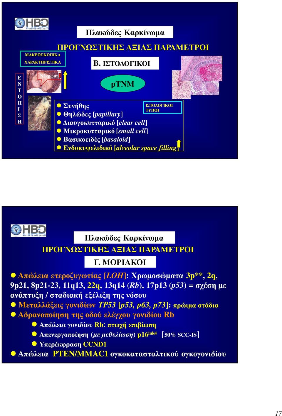 [alveolar space filling] Πλακώδες Καρκίνωµα ΠΡΟΓΝΩΣΤΙΚΗΣ ΑΞΙΑΣ ΠΑΡΑΜΕΤΡΟΙ Γ.