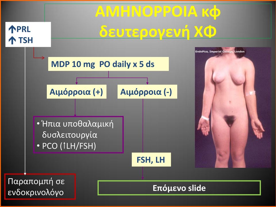 (-) Ήπια υποθαλαμική δυσλειτουργία PCO (