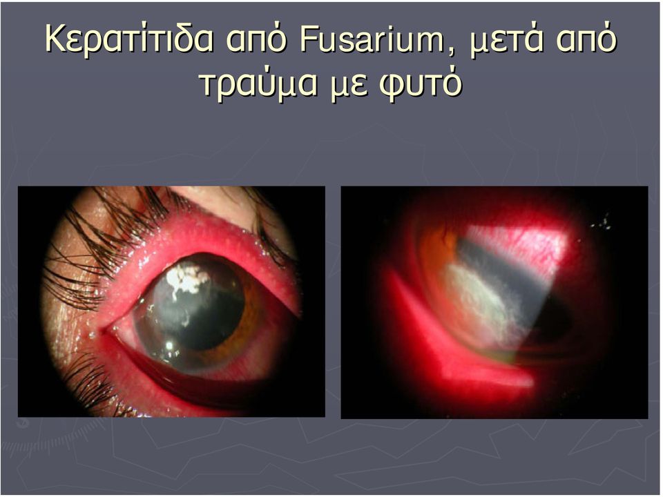 Fusarium,