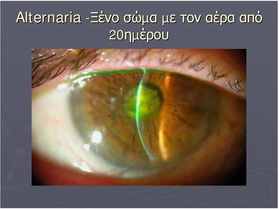 σώµα µε τον