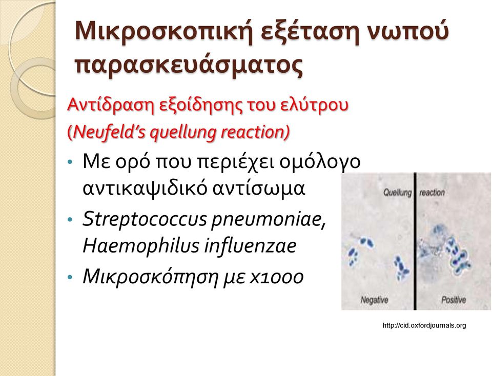 ομόλογο αντικαψιδικό αντίσωμα Streptococcus pneumoniae,