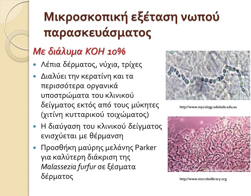 κυτταρικού τοιχώματος) Η διαύγαση του κλινικού δείγματος ενισχύεται με θέρμανση Προσθήκη μαύρης μελάνης Parker