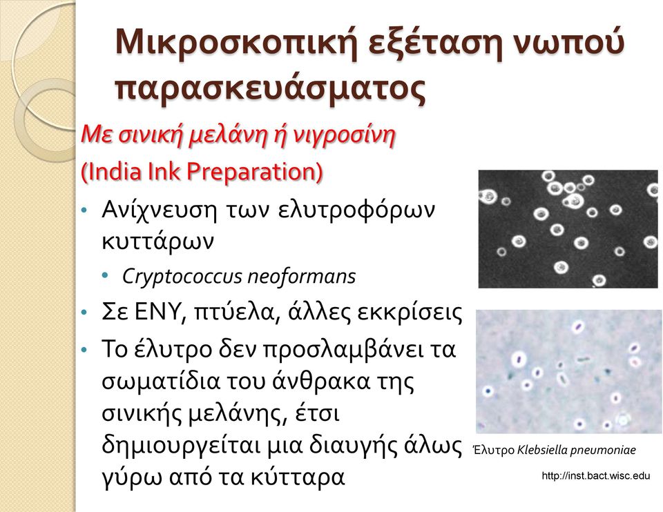 άλλες εκκρίσεις Το έλυτρο δεν προσλαμβάνει τα σωματίδια του άνθρακα της σινικής μελάνης,