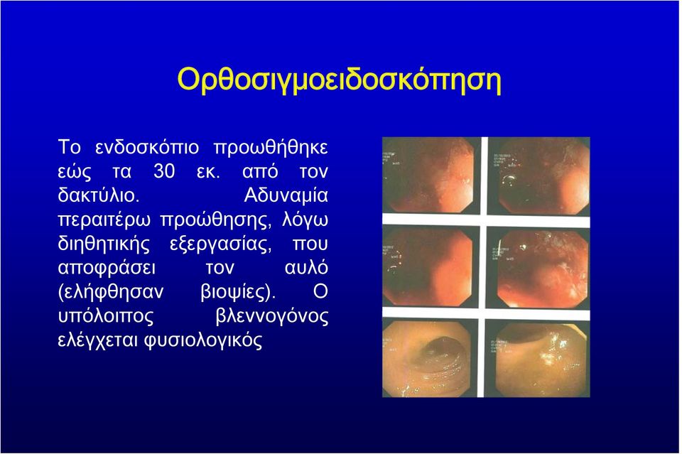 Αδυναμία περαιτέρω προώθησης, λόγω διηθητικής