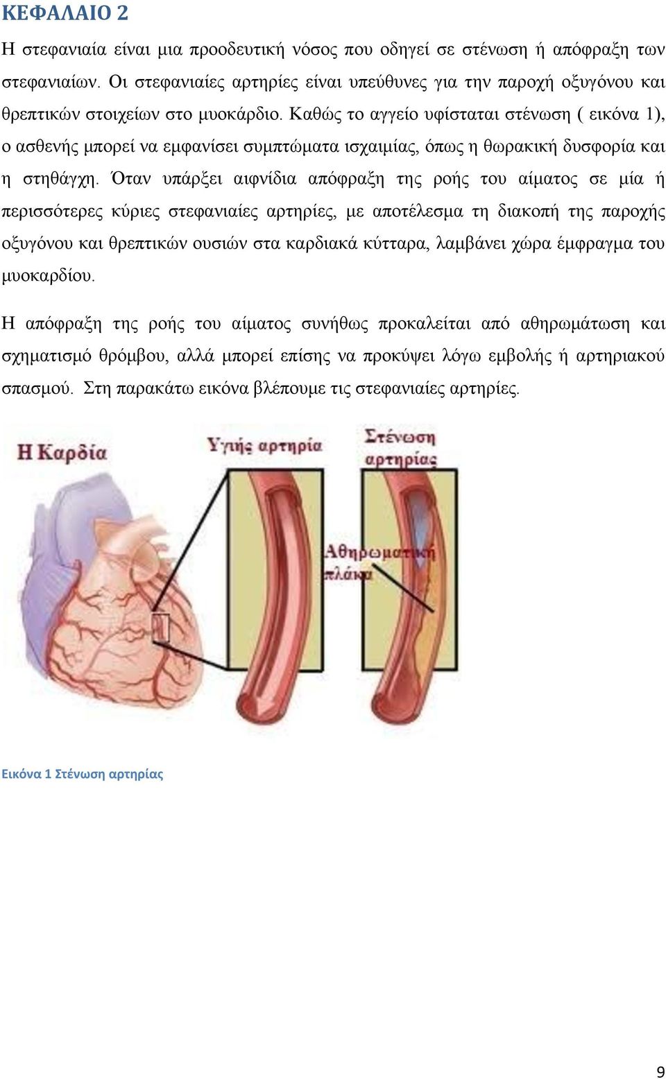 Καθώς το αγγείο υφίσταται στένωση ( εικόνα 1), ο ασθενής μπορεί να εμφανίσει συμπτώματα ισχαιμίας, όπως η θωρακική δυσφορία και η στηθάγχη.