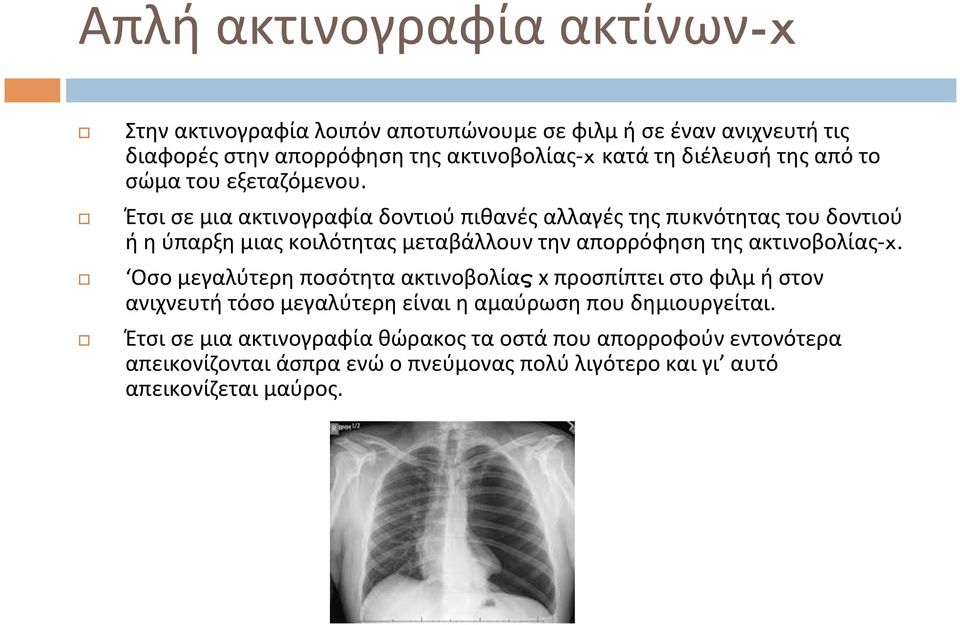 Έτσι σε μια ακτινογραφία δοντιού πιθανές αλλαγές της πυκνότητας του δοντιού ή η ύπαρξη μιας κοιλότητας μεταβάλλουν την απορρόφηση της ακτινοβολίας- x.