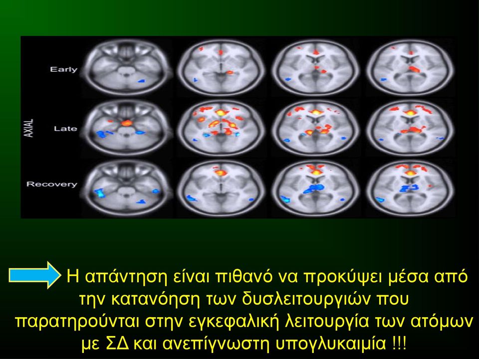 παρατηρούνται στην εγκεφαλική λειτουργία