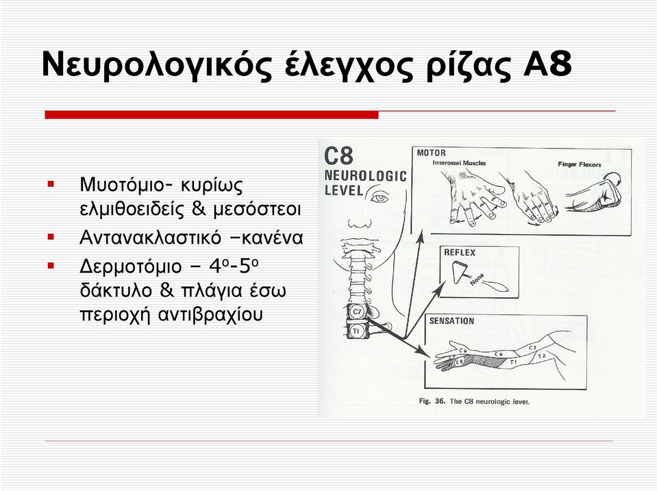 µεσόστεοι Αντανακλαστικό κανένα