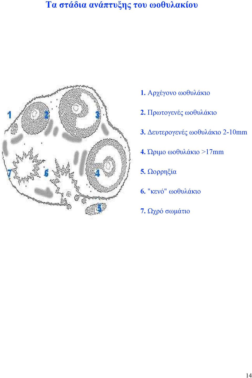 ευτερογενές ωοθυλάκιο 2-10mm 4.