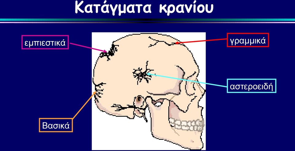 εμπιεστικά