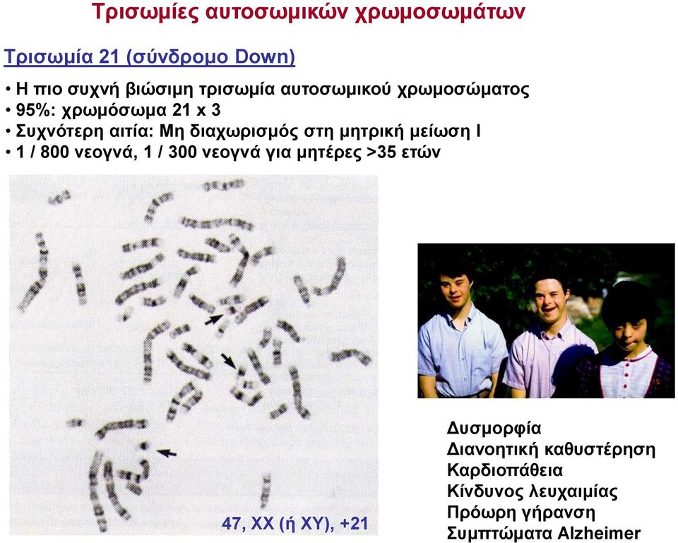 στη μητρική μείωση Ι 1 / 800 νεογνά, 1 / 300 νεογνά για μητέρες >35 ετών 47, ΧΧ (ή ΧΥ),