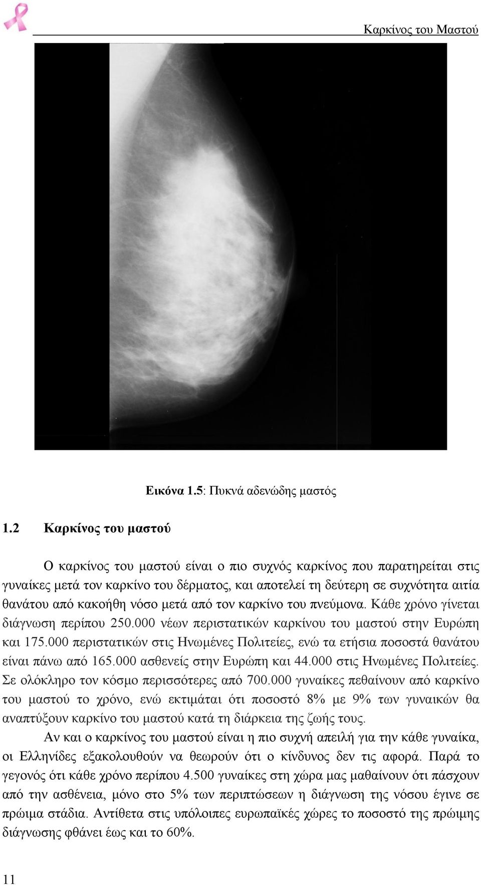 νόσο µετά από τον καρκίνο του πνεύµονα. Κάθε χρόνο γίνεται διάγνωση περίπου 250.000 νέων περιστατικών καρκίνου του µαστού στην Ευρώπη και 175.