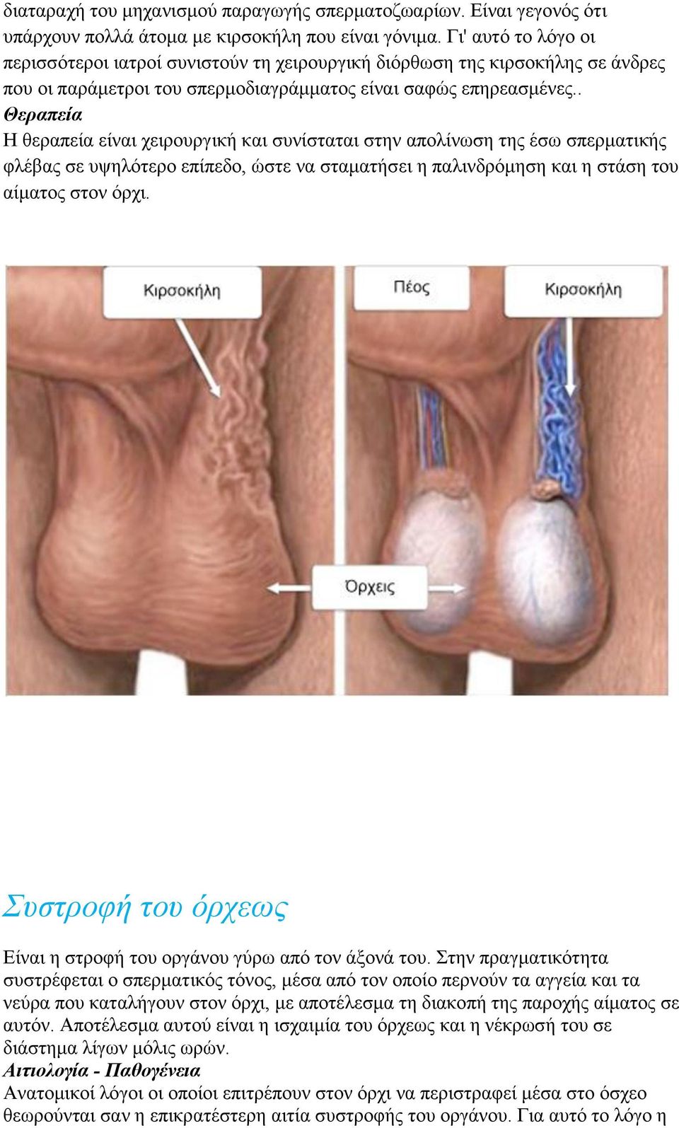 . Η θεραπεία είναι χειρουργική και συνίσταται στην απολίνωση της έσω σπερματικής φλέβας σε υψηλότερο επίπεδο, ώστε να σταματήσει η παλινδρόμηση και η στάση του αίματος στον όρχι.
