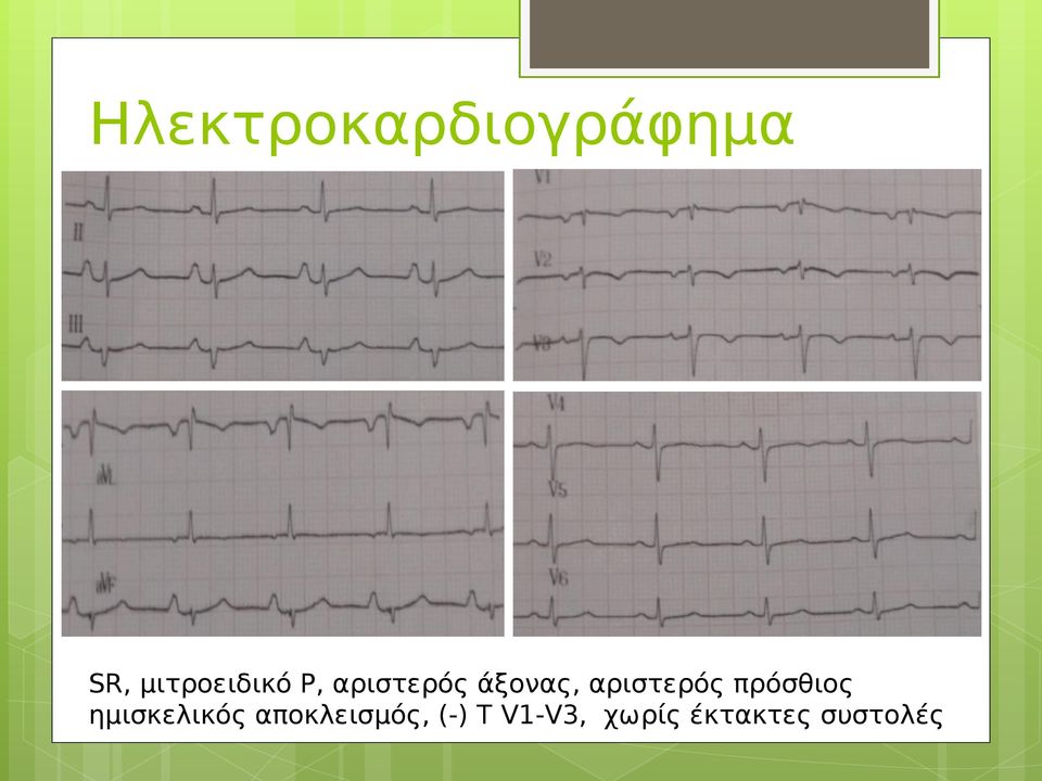 αριστερός πρόσθιος ημισκελικός