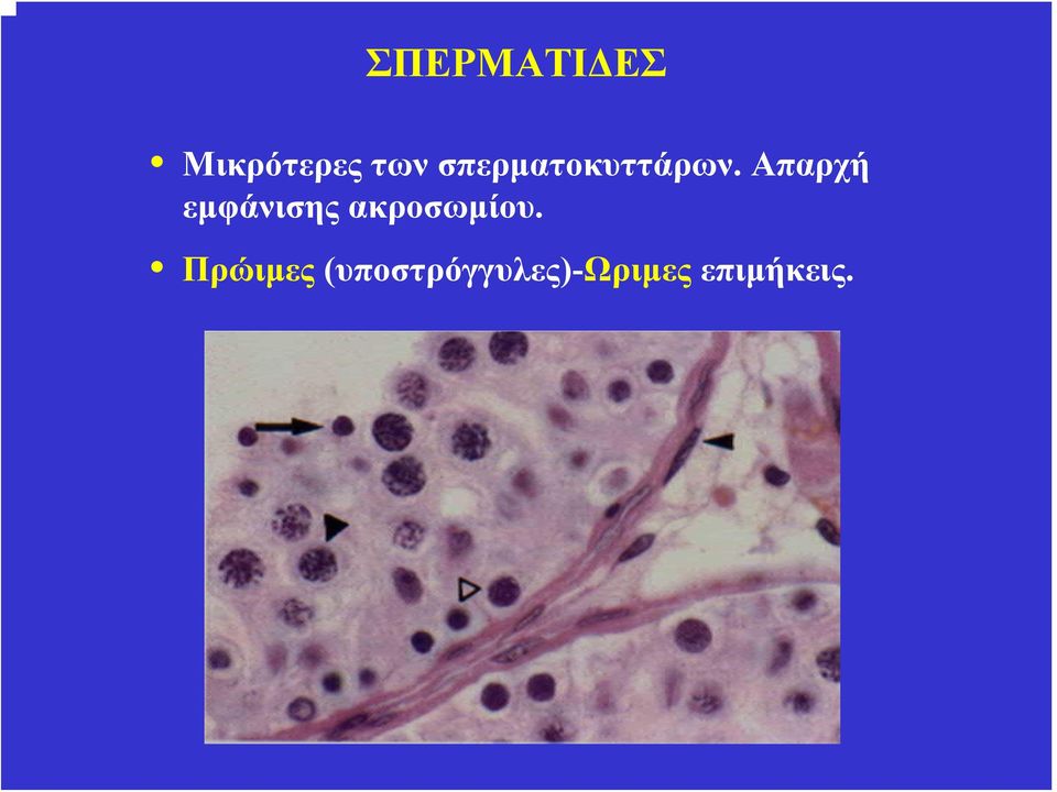 Απαρχή εμφάνισης ακροσωμίου.